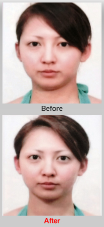 小顔・美顔エステ